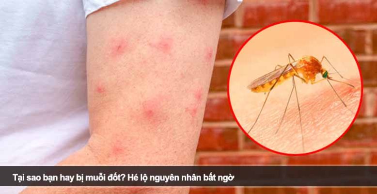 Tại sao bạn hay bị muỗi đốt? Hé lộ nguyên nhân bất ngờ
